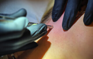 Dermal Anchor wird professionell am Hals gesetzt – steriles Arbeiten im Tattoo Studio Berlin Charlottenburg