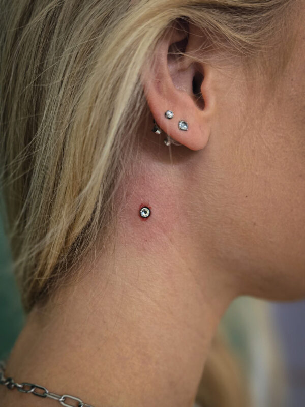 Frisch gesetzter Dermal Anchor am Hals mit leicht geröteter Haut – professionelle Durchführung Berlin