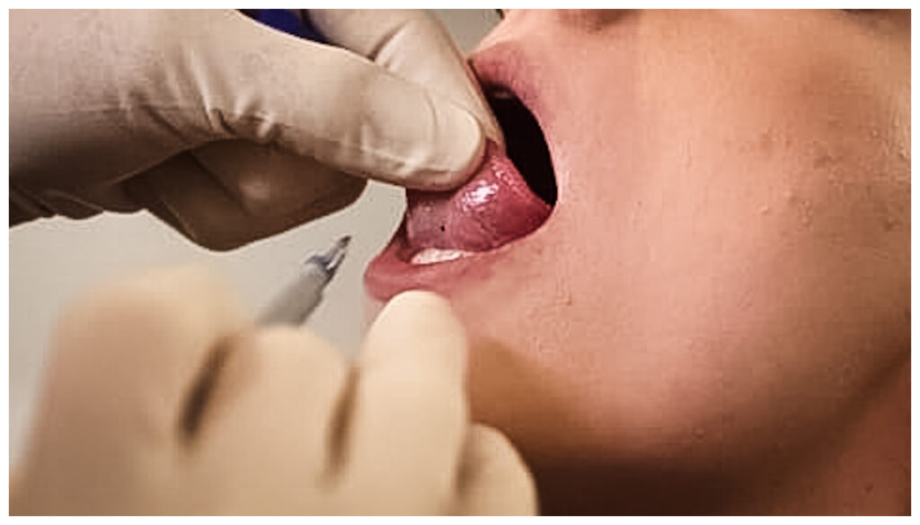 Piercer prüft die Zungenspitze und Position für ein Snake Eye Piercing im Autark Tattoo & Piercing Studio Berlin Charlottenburg.