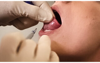 Piercer prüft die Zungenspitze und Position für ein Snake Eye Piercing im Autark Tattoo & Piercing Studio Berlin Charlottenburg.