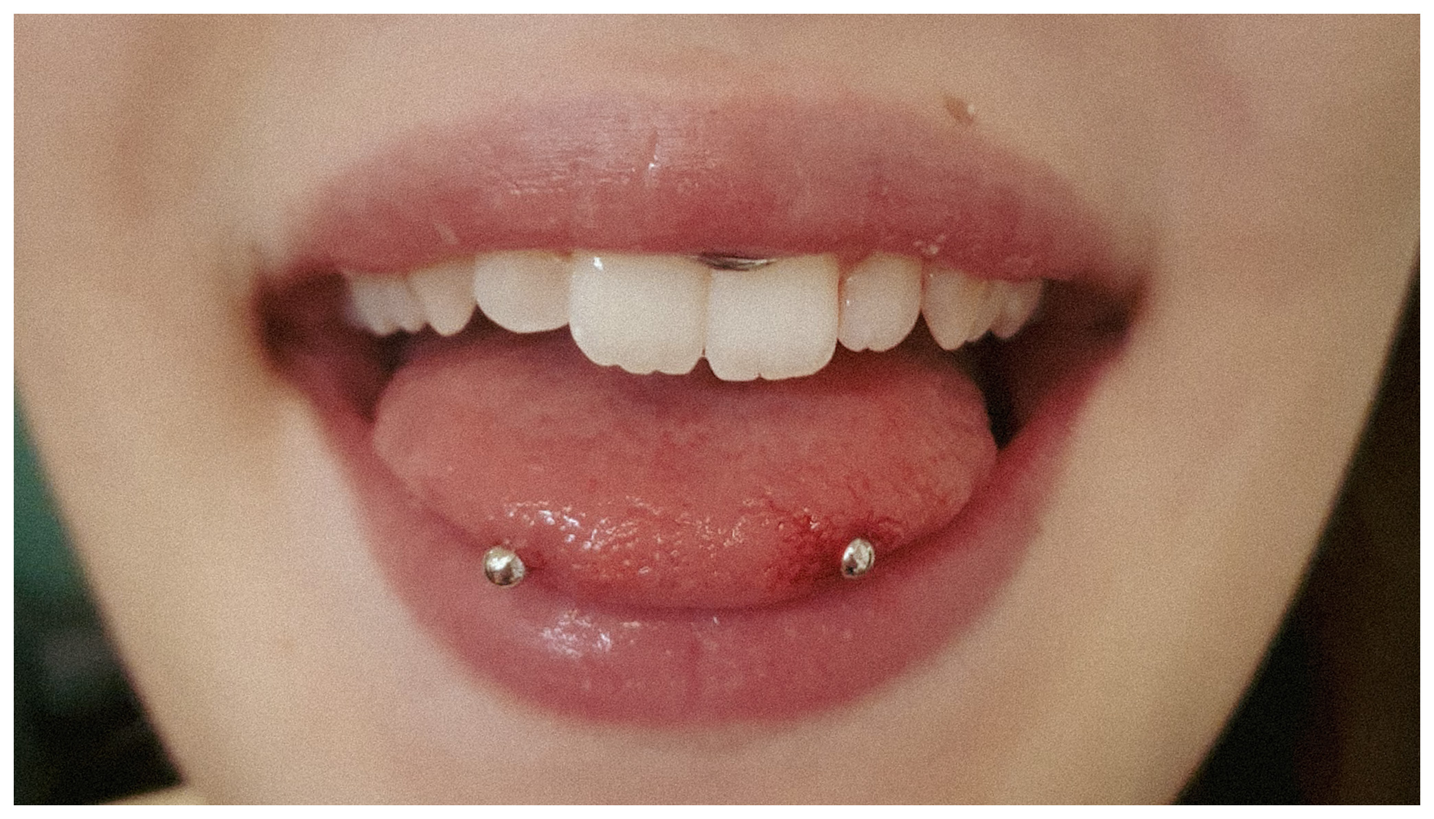 Snake Eye Piercing auf der Zungenspitze mit zwei Kugeln im Autark Tattoo & Piercing Studio Berlin Charlottenburg.