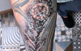 Entzündetes Tattoo – typische Anzeichen einer starken Hautreaktion Stark entzündetes Tattoo am Unterarm mit Krustenbildung, Rötungen und Hautreaktionen nach dem Tätowieren