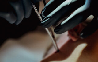 Detailaufnahme Dermal Anchor einsetzen – sterile Technik im Tattoo Studio Berlin