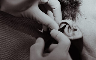 Ohrpiercing mit sichtbarer Wildfleischbildung im Knorpelbereich trotz eingesetztem Schmuck