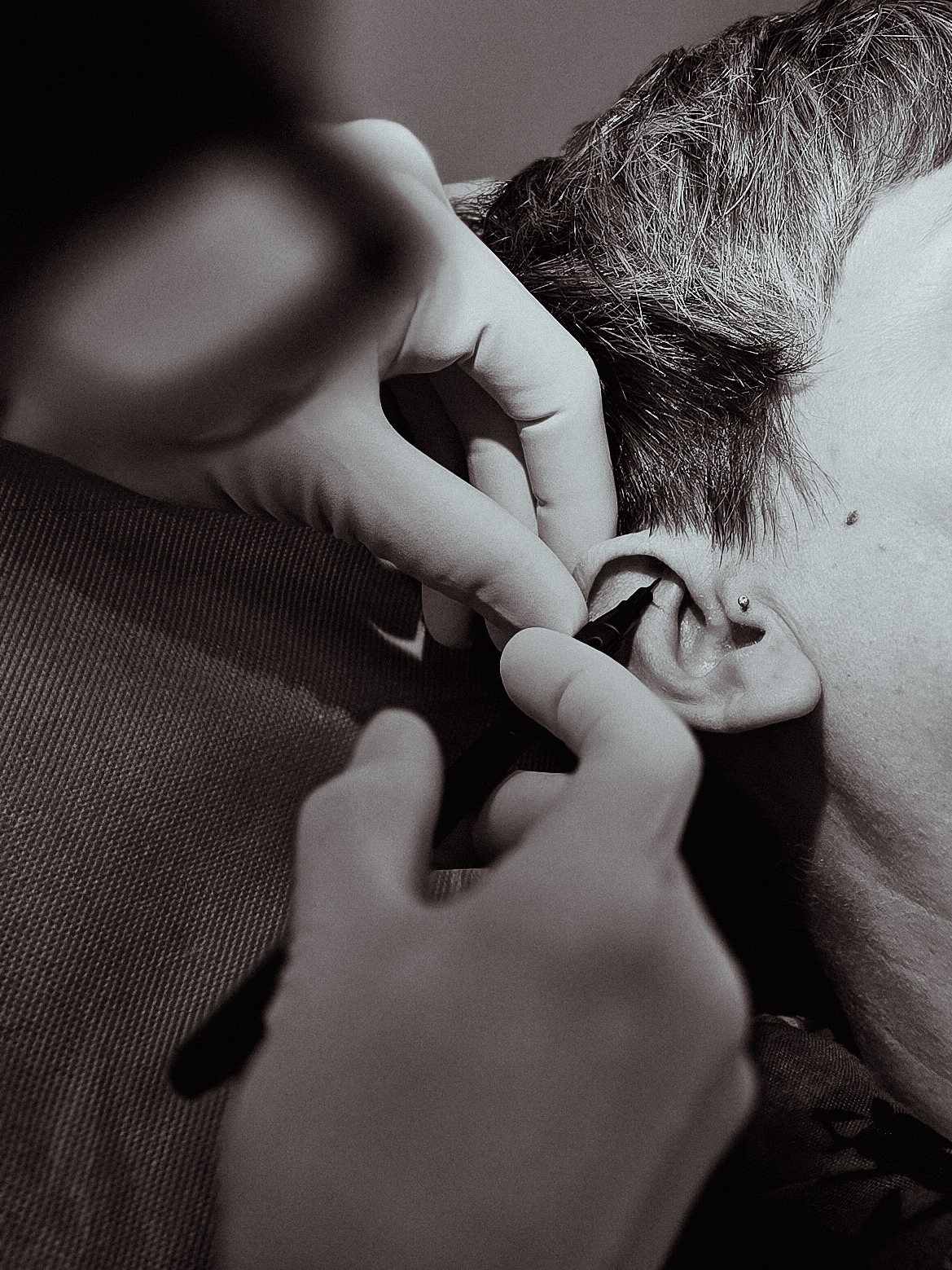 Ohrpiercing mit sichtbarer Wildfleischbildung im Knorpelbereich trotz eingesetztem Schmuck